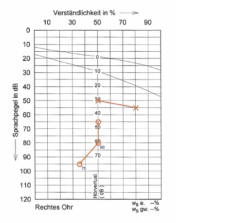 Sprachaudiogram_jpg.jpg