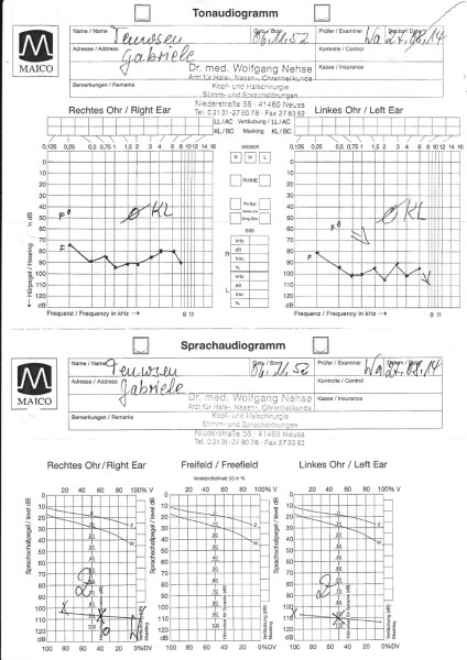 verkleinerte Hörkurve.jpg
