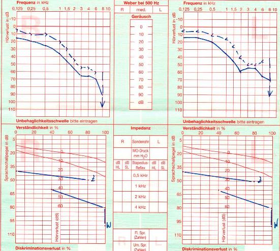 Audiogramm.jpg