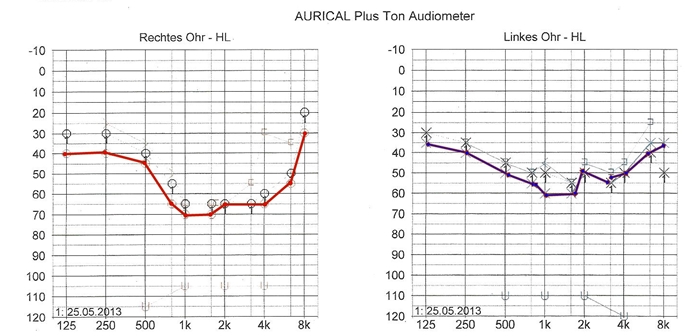 Hörtest2.jpeg