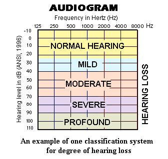 audiogramloss.gif