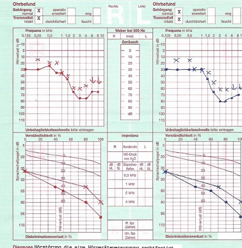 hördiagram (623x640) (487x500).jpg