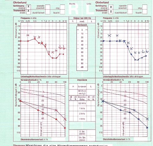hördiagram (500x478).jpg