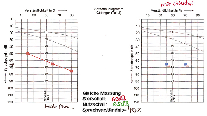 Sprachaudiogramm.jpg