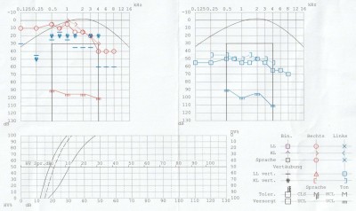 audiogramm 04.2023 kopie1.jpg