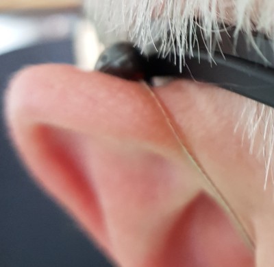 Rechtes Ohr mit HdO Hörgerät
