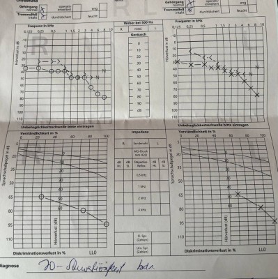 Hörkurven 01.03.2024.jpg