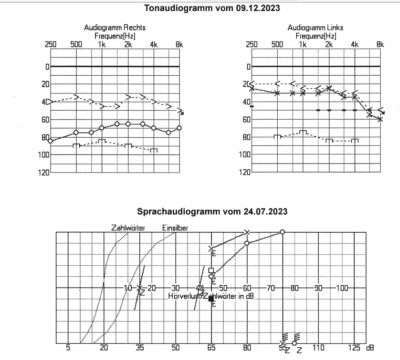 Hörtest zugeschnitten.PNG