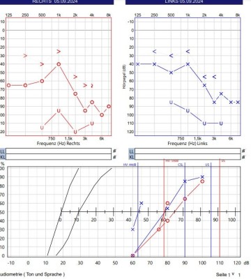 Audiogramm 05.09.2024.jpg