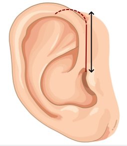AuriculaLaenge.jpg