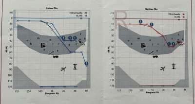 Audiogramm 1 - 24.07.25.jpg