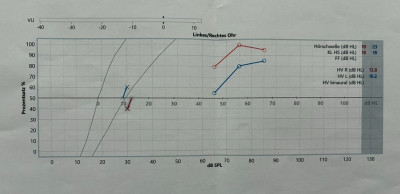 Audiogramm 2 - 24.07.25.jpg
