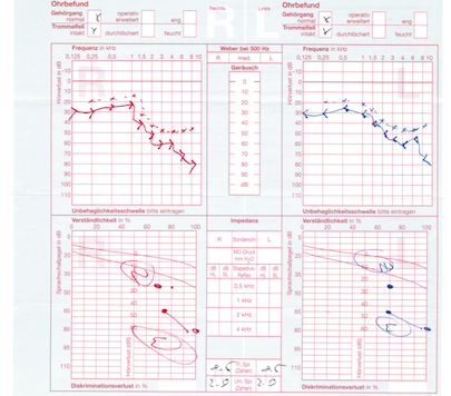 Audiogramm.png